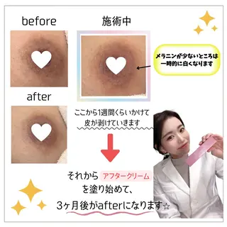 本気で痩せたい方へ 痩身専門サロンのその他イメージ