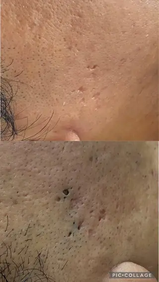 メンズ Esthetic Will所属・will 有希のネイルデザイン