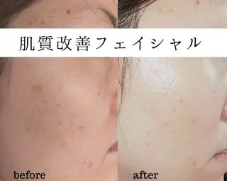 ユニセックスエステサロンUniclear所属・男女エステ ユニクリアのエステ・リラクイメージ