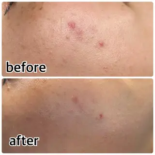 Gemini 　MIKIのエステ・リラクイメージ