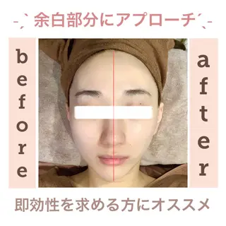 エステサロン JURISのエステ・リラクイメージ