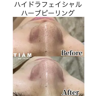 美肌サロンTIAM by tetoteのエステ・リラクイメージ