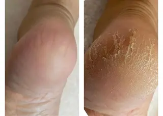 ネイル Esthetic Will所属・will 有希のネイルデザイン