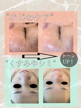 Beauty Maxのエステ・リラクイメージ