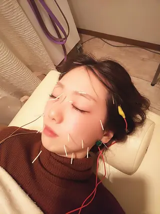 むくみたるみ専門☆ 美容鍼・小顔矯正のエステ・リラクイメージ