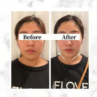 12Dハイフ💗 最強小顔のエステ・リラクイメージ
