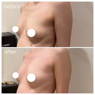 beautysalon RAVIS所属・東大阪/韓国肌管理/ 痩身バスト専門店のエステ・リラクイメージ