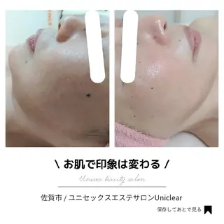 ユニセックスエステサロンUniclear所属・男女エステ ユニクリアのエステ・リラクイメージ