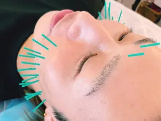 メンズ 小顔美容鍼専門サロン 渋谷YZのエステ・リラクイメージ