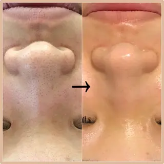 美容整体サロン Melalinoのエステ・リラクイメージ