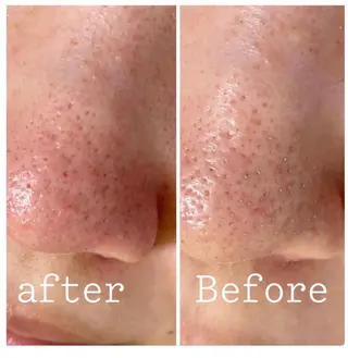 都度払い肌改善専門店 店長二上文香のエステ・リラクイメージ