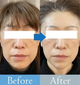 美肌/小顔/眉毛の 専門店 ルミナスの眉毛・アイブロウイメージ