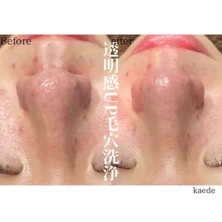 🎀kaede🎀 骨格似合わせ眉毛の眉毛・アイブロウイメージ