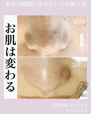 毛穴汚れ改善専門店/ 岸和田/リヒオルオルのエステ・リラクイメージ