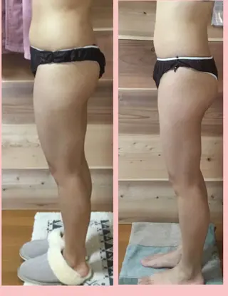 private salon Dea_maris シュガーリング&パーソナルボディケア所属・シミ改善・韓国肌管理 ボディメイク痩身のその他イメージ