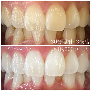 PLATINUM Beauty 横浜店所属・ホワイトニングルーム 横浜店のその他イメージ