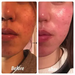 フェアリーローズ所属・fairyrose organicエステのエステ・リラクイメージ