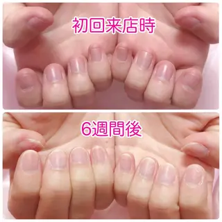 ネイル 深爪を断らない スカルプ高評価店のネイルデザイン