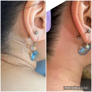 毛穴レス ハーブ& ワックス脱毛×光脱毛のエステ・リラクイメージ