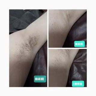 beauty salon La Luce所属・la luceのエステ・リラクイメージ