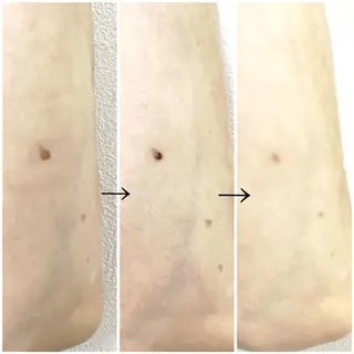 SHINY エステサロンのその他イメージ