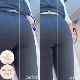 アンテインチル 山本のエステ・リラクイメージ