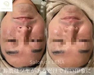ハーブピーリング・毛穴ケア専門サロンSalon de LENA 栄店所属・ハーブピーリング専門 サロンドレナ　白藤のエステ・リラクイメージ