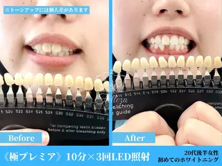 有人型セルフサロン 脱毛/痩身/美顔のその他イメージ