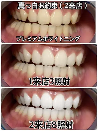 ホワイトニングビューティー西宮店所属・ホワイトニングビュー ティー西宮店のその他イメージ