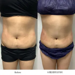 冷却専門店 SLARIのエステ・リラクイメージ