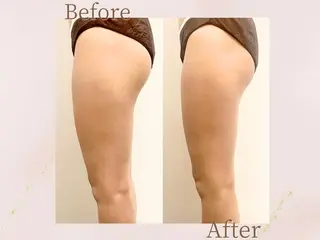 森近 美優のエステ・リラクイメージ