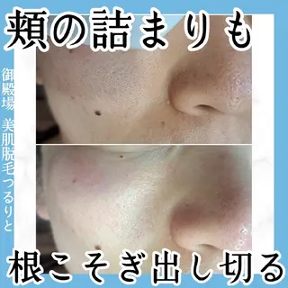 美肌脱毛サロン つるりと御殿場店所属・美肌脱毛サロン つるりとのその他イメージ