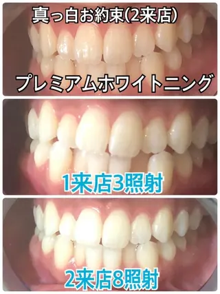 メンズ ホワイトニングビューティー西宮店所属・ホワイトニングビュー ティー西宮店のその他イメージ