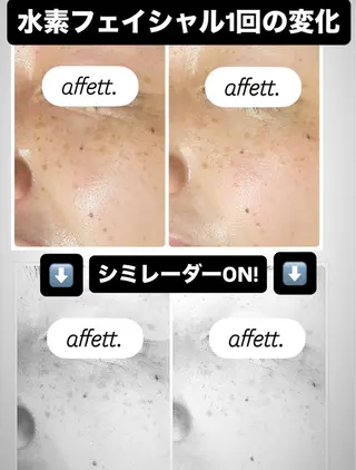 肌質改善&アロマサロンaffett.所属・澤井 千晴のエステ・リラクイメージ