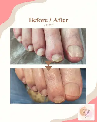 フットケアサロン miraiのその他イメージ