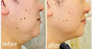 シミ・たるみ・毛穴ケア専門サロン Alluring所属・シミたるみ毛穴ケア 中村のエステ・リラクイメージ