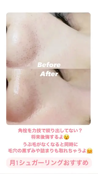 Hit. シュガーリング豊橋のエステ・リラクイメージ