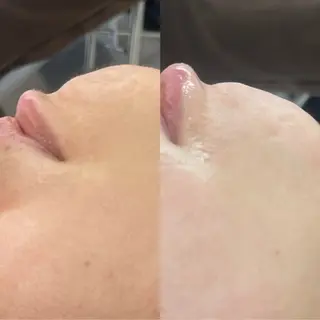 suu ｜harukaのマツエク・マツパデザイン