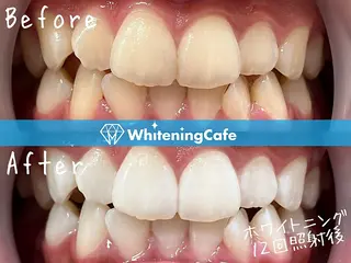 ホワイトニングカフェ原宿店所属・ホワイトニングカフェ 原宿店のエステ・リラクイメージ