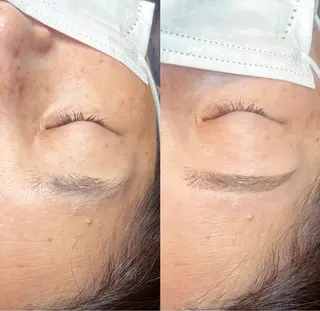 アイブロウ 脱毛/毛穴ケア/小顔 博多アンドナイン平尾の眉毛・アイブロウイメージ