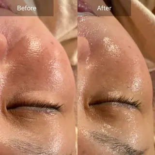 Mandarin Orange所属・毛穴から始める肌メン テマンダリンオレンジのエステ・リラクイメージ