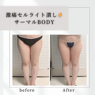 小顔矯正専門店 【RED】池田のエステ・リラクイメージ