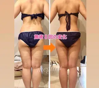 ショート カラー パーマ ヘアアレンジ メンズ キッズ ネイル マツエク・マツパ ‍痩身＆ボディ 結果出し🌟丹野のエステ・リラクイメージ