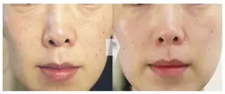 LiZA エステティックサロンのエステ・リラクイメージ