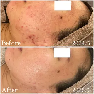 etes （エトエス）所属・etes.tokyo 中目黒のエステ・リラクイメージ