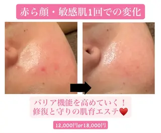 DECIDE L.A.W所属・太田 女久美のエステ・リラクイメージ