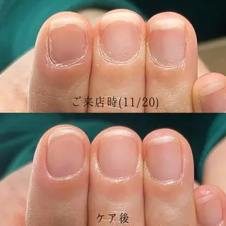 ネイル Aim* 深爪・爪育ケア専門店のネイルデザイン