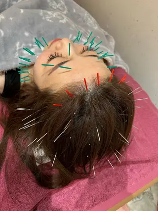 美容鍼灸女性専用 りんご鍼灸治療院のその他イメージ