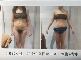 脱毛フェイシャル痩身 エリア最安👑永野舞のエステ・リラクイメージ