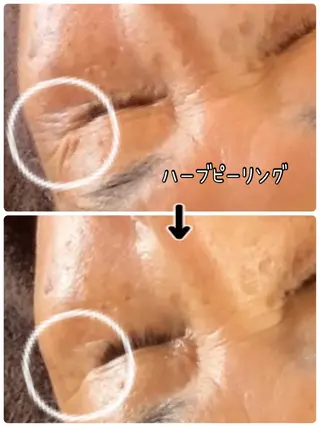 どんぐりエステルーム 🍄みゆきの眉毛・アイブロウイメージ